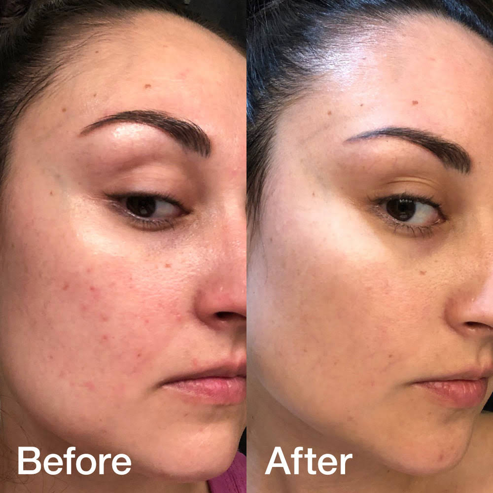 Collagen Toner And Serum Duo