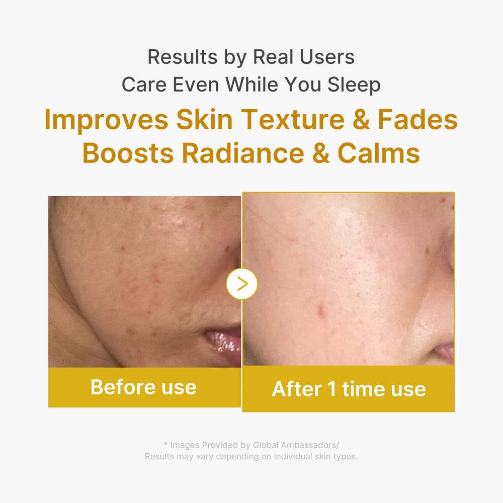 Kojic Acid Turmeric Overnight Peel-Off Mask