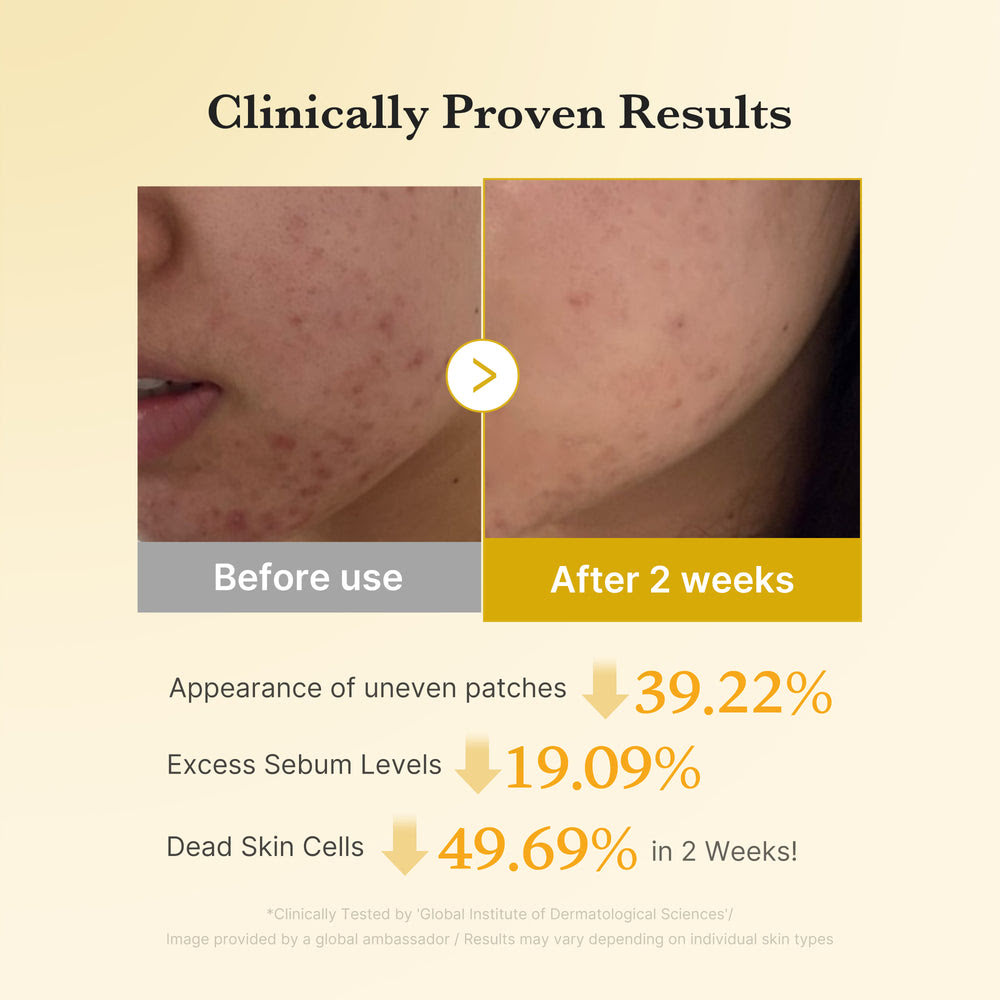 Kojic Acid Turmeric Toner Pads