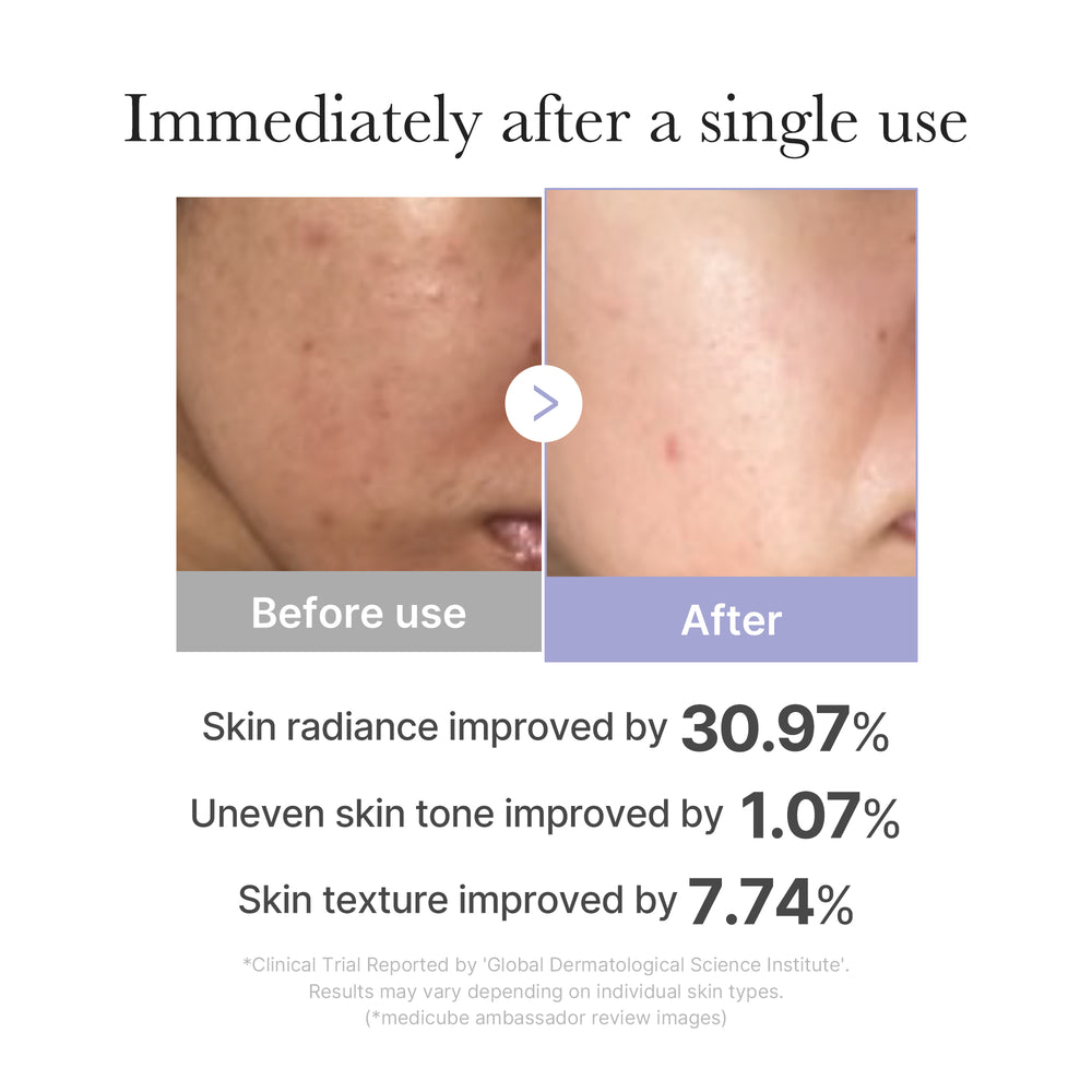 White Portable Facial Care Wand