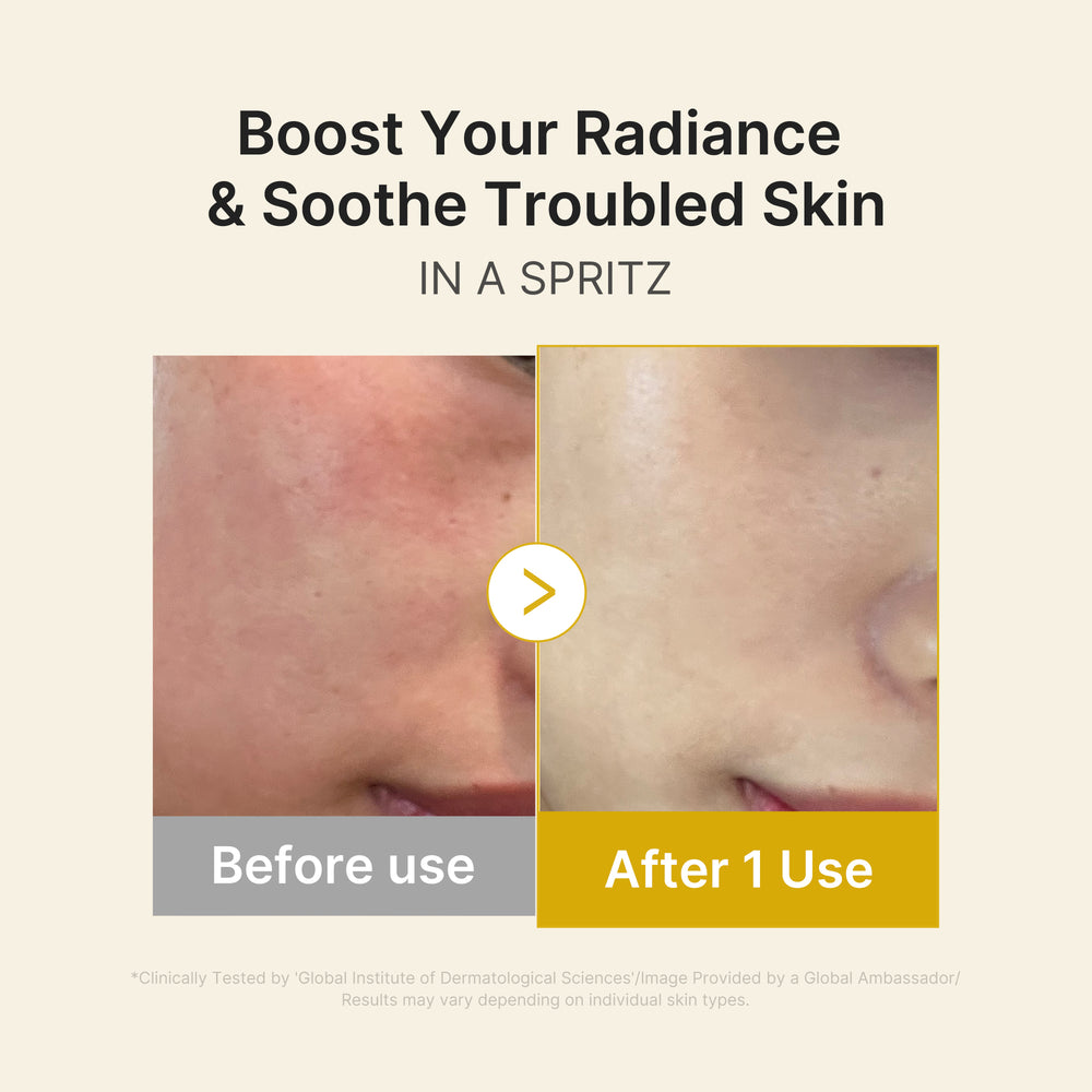 Kojic Acid Turmeric Jelly Mist Serum