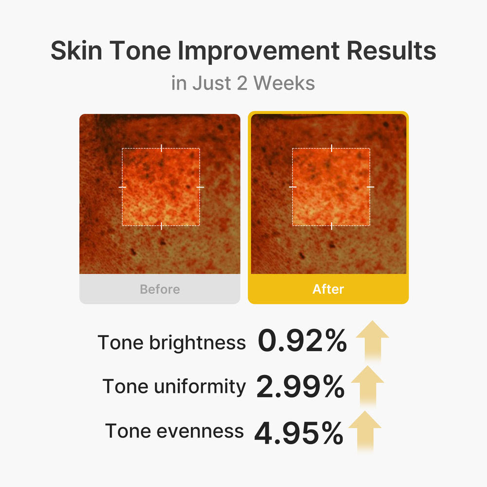 Kojic Acid Turmeric Capsule Face Cream