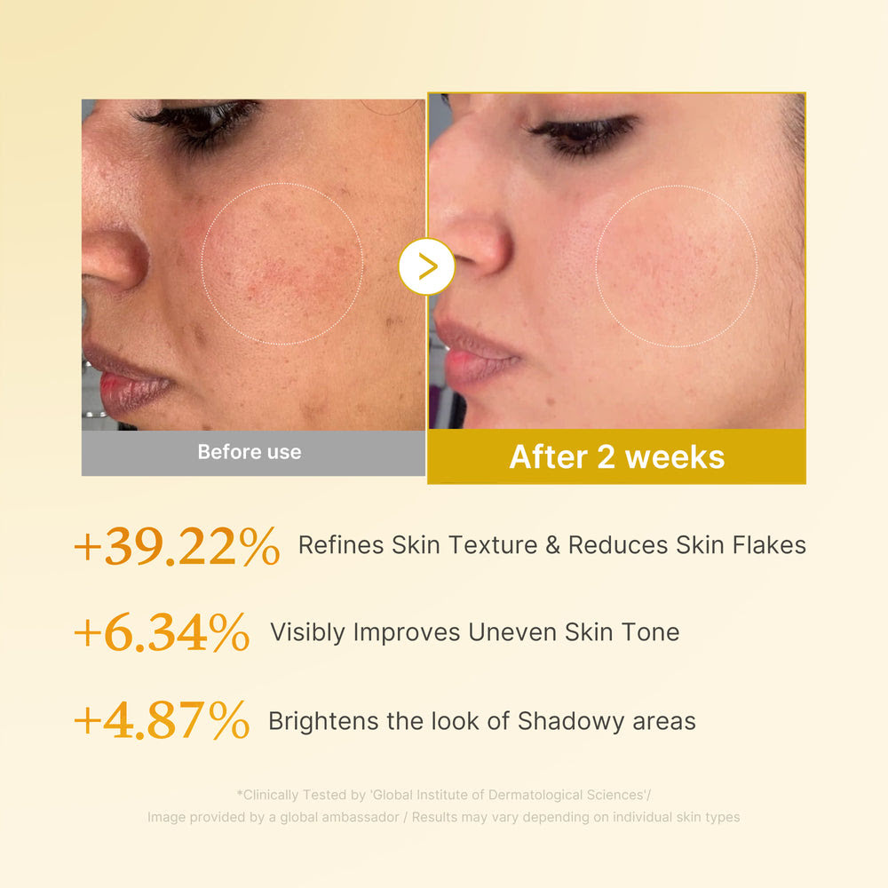 Kojic Acid Turmeric Face & Body Toner