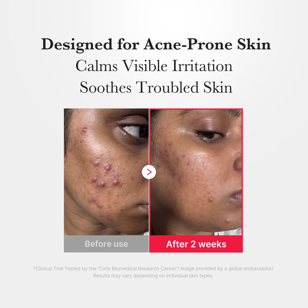 Hypochlorous Acid Soothing Facial Spray