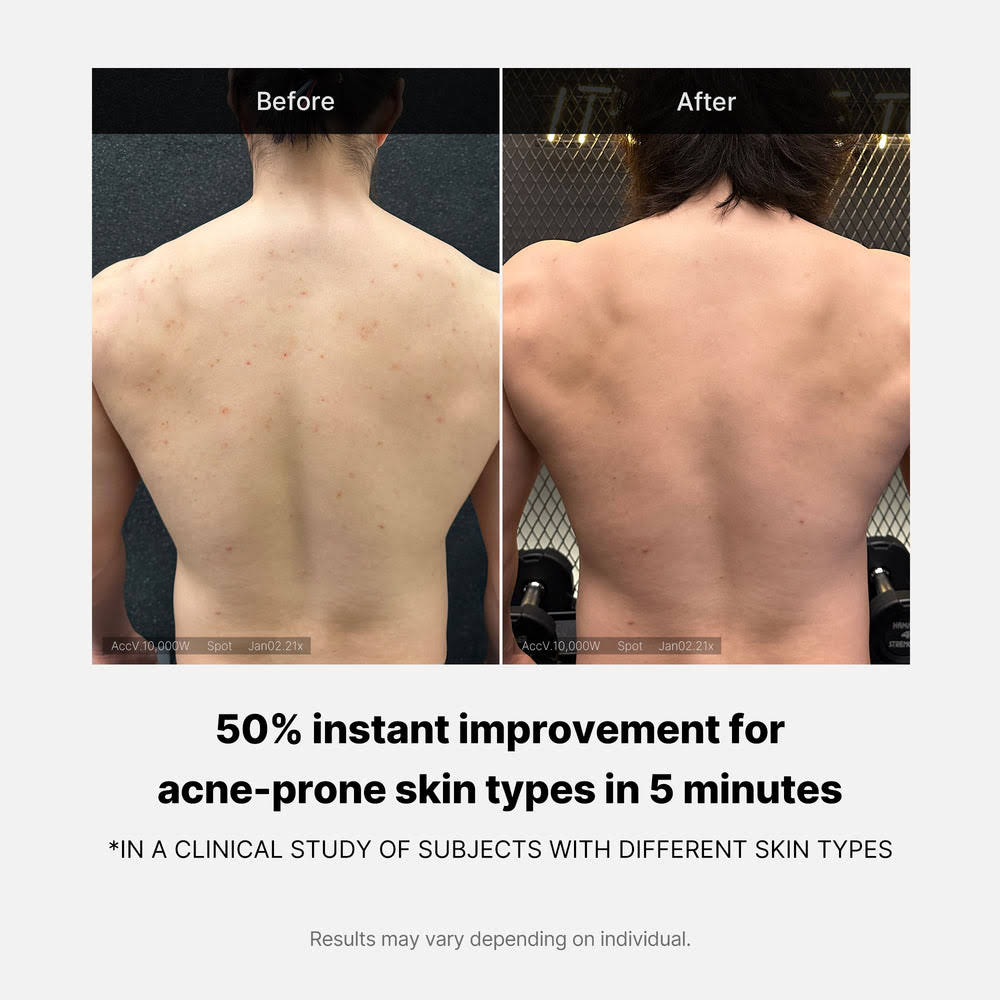 Salicylic Acid Body Wash