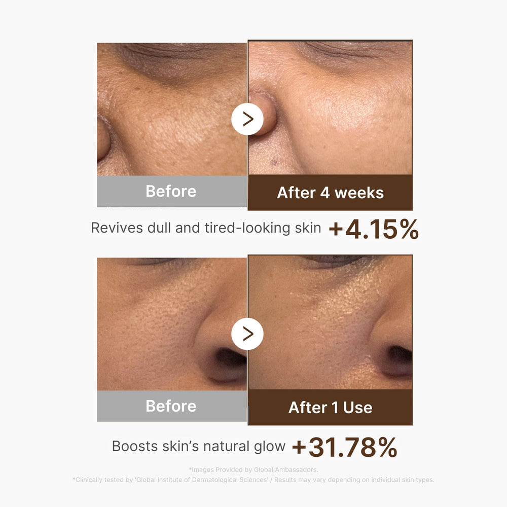 Vitamin C Capsule Facial Serum
