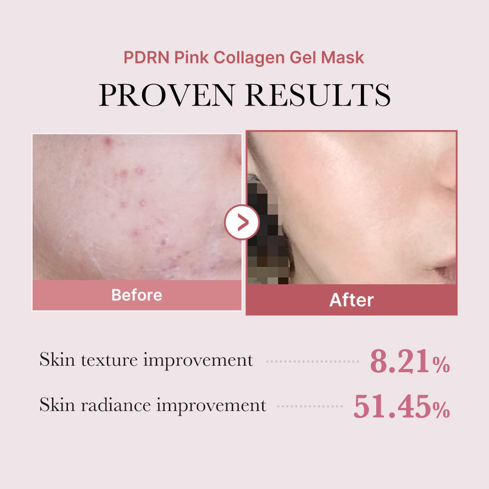 PDRN Hydrating Skin Care Set