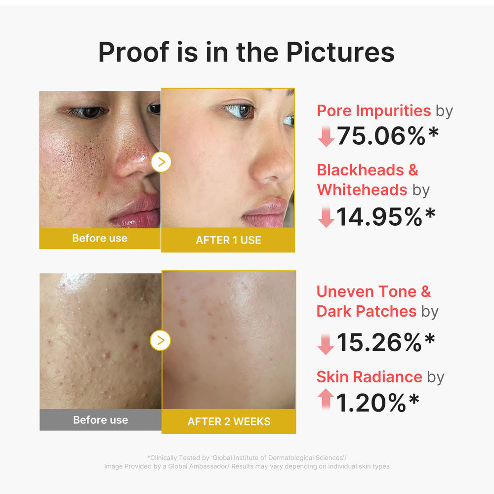 Kojic Acid Turmeric Facial Peel Serum